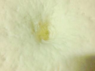 7、红糖伍仁馅糖三角,面团发酵到两倍大，按一下，孔不会回弹，就是发酵好了。