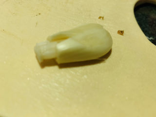 5、炒牛肝菌,蒜瓣剥皮，拍扁；