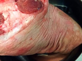 1、自制酱肘子,首先准备一个前猪肘,用水清洗,把肘子放在一锅凉水里烧开,肘子捞出,放凉一会,放在燃气火把猪肘子的毛烧干净之后再放水里清洗,用刀把猪皮上的脏东西挂干净!