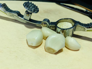 3、蒜蓉粉丝蒸生蚝,蒜瓣，去皮，洗净；