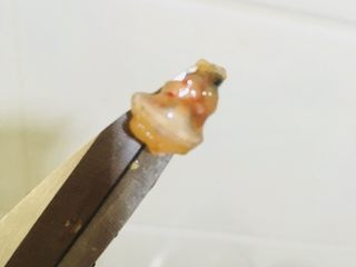 5、蒜蓉小龙虾,把头的脏东西给弄出来弃之，如图